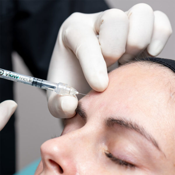 Traitement de la ride du lion par injections de Botox